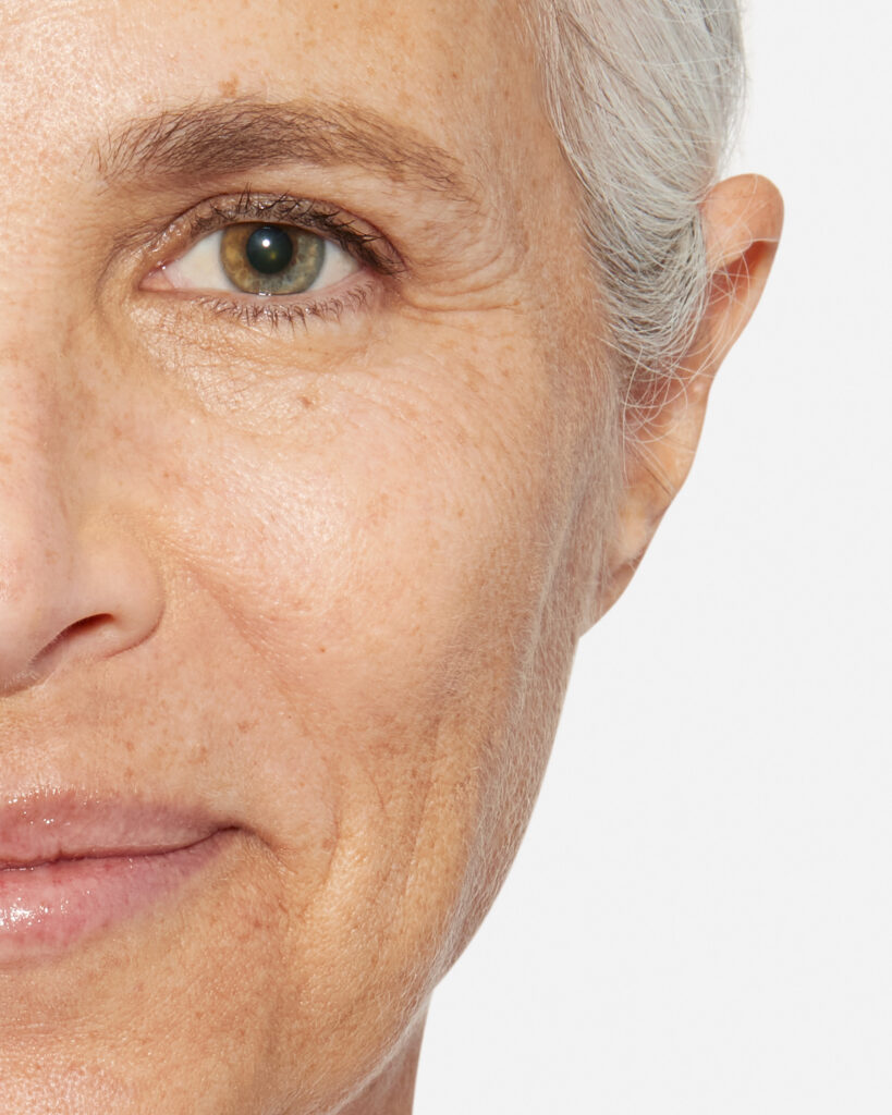 Anti-Aging Behandlung für gesunde und strahlende Haut bei BellaFrieda Beauty in Berlin Prenzlauer Berg