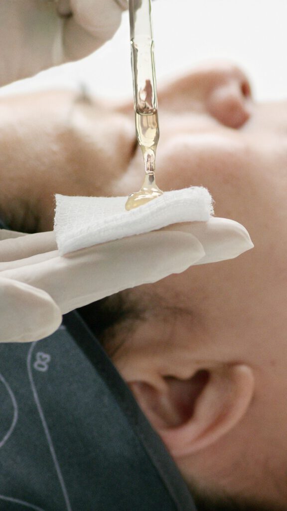 Fruchtsäurepeeling zur Hauterneuerung bei BellaFrieda Beauty in Berlin Prenzlauer Berg