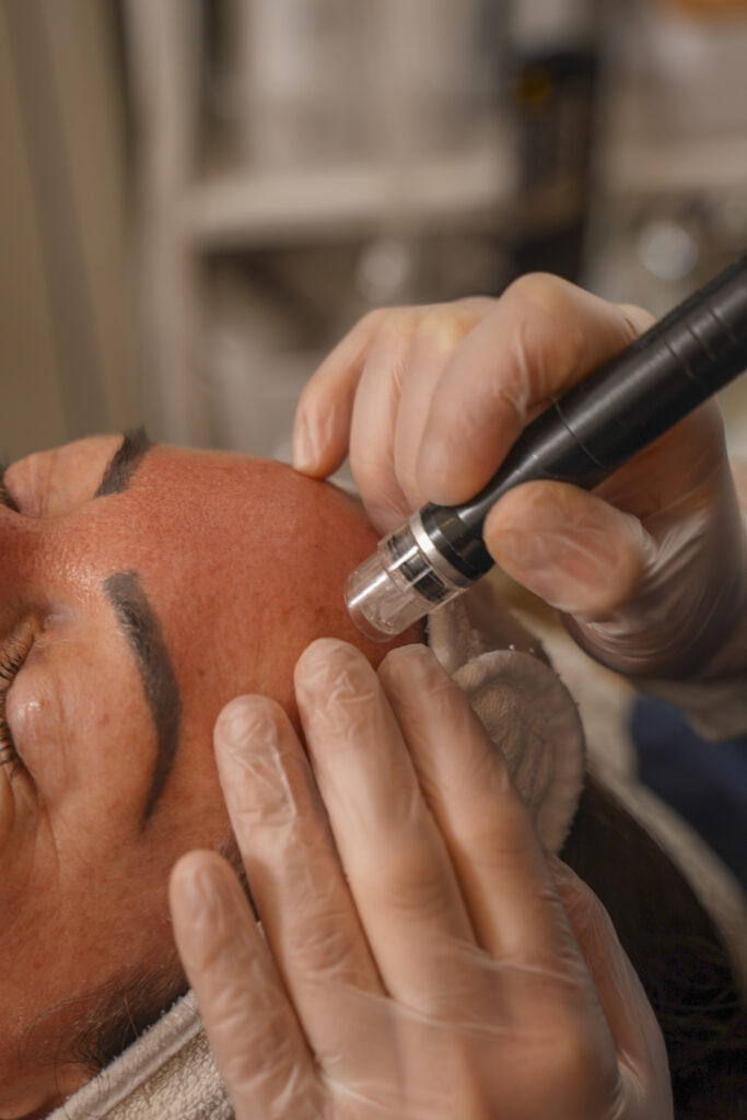 Aquafacial zur Tiefenreinigung und Hydration bei BellaFrieda Beauty in Berlin Prenzlauer Berg