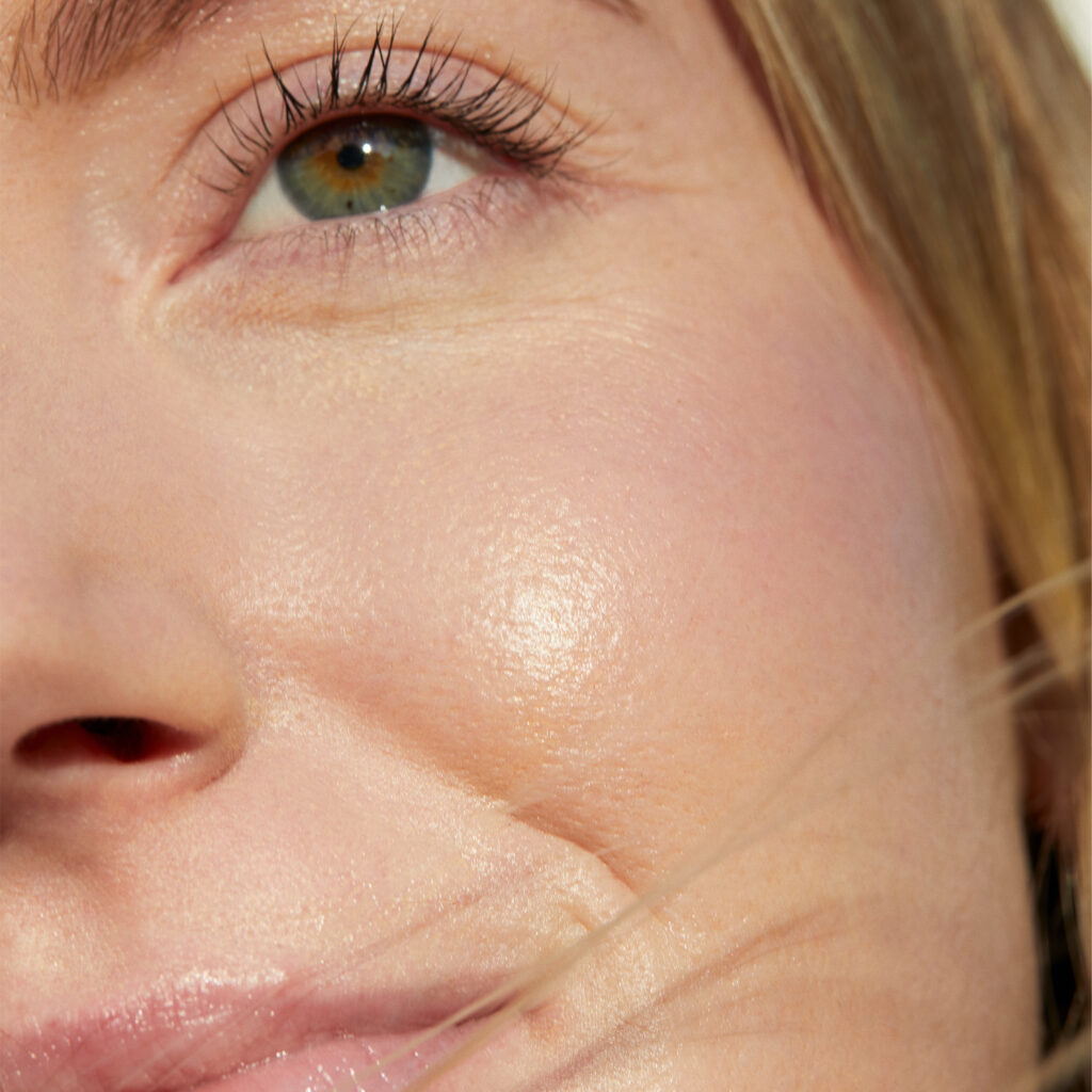 Nahaufnahme der Augenpartie vor einer Permanent-Concealer-Behandlung